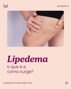 O que é Lipedema